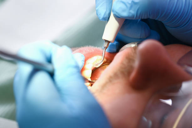 Best Mobile Emergency Dentist in Hollins, VA