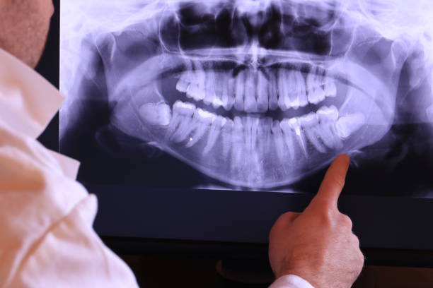 Best Broken or Cracked Tooth Emergency Dentist in Hollins, VA