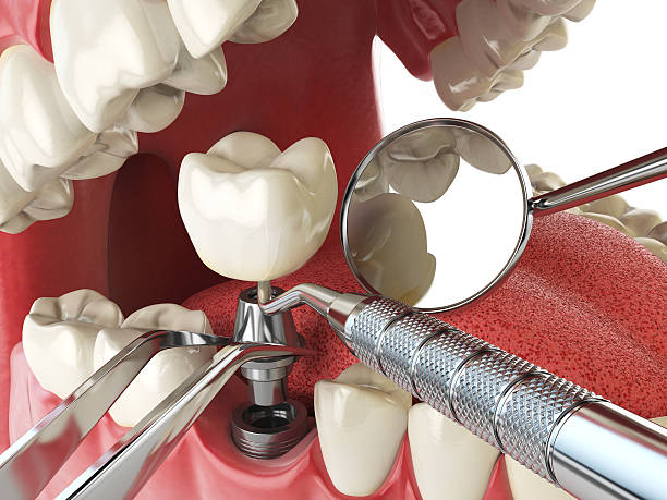 Best Mobile Emergency Dentist in Hollins, VA